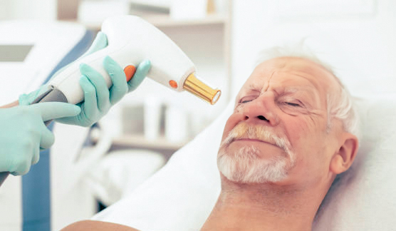 épilation laser paris