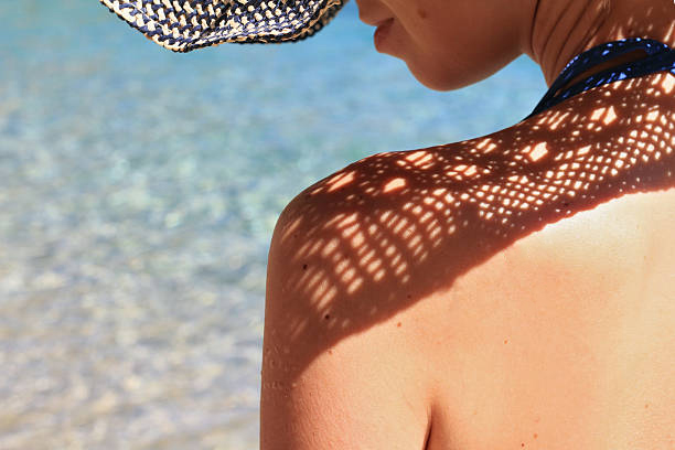 tâches de soleil bronzage peau femme Elysées Derm